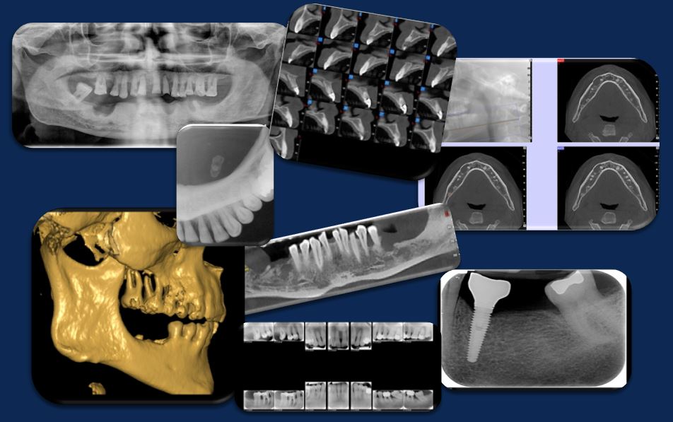 Specialized-rad-sections